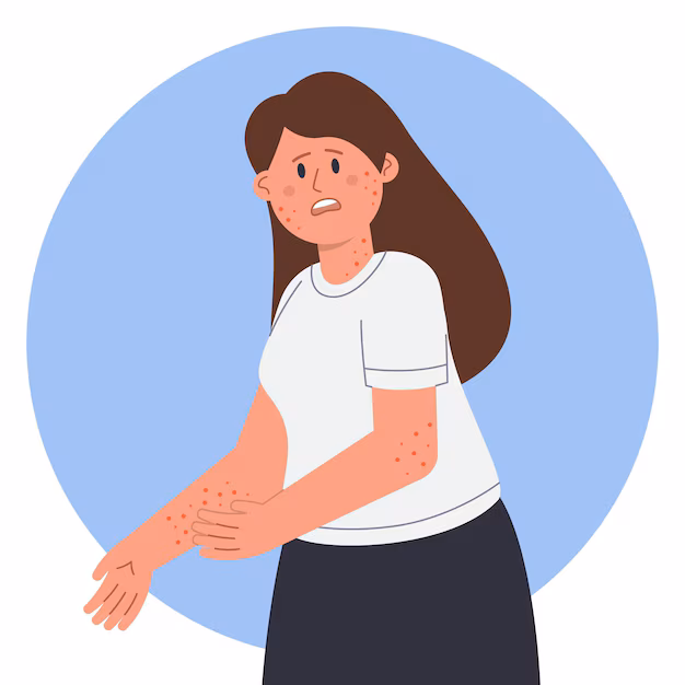 Are you itchy?