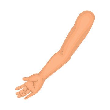 Arm 
