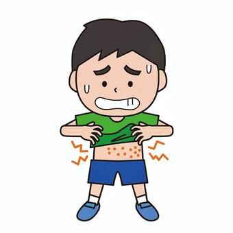 Rash