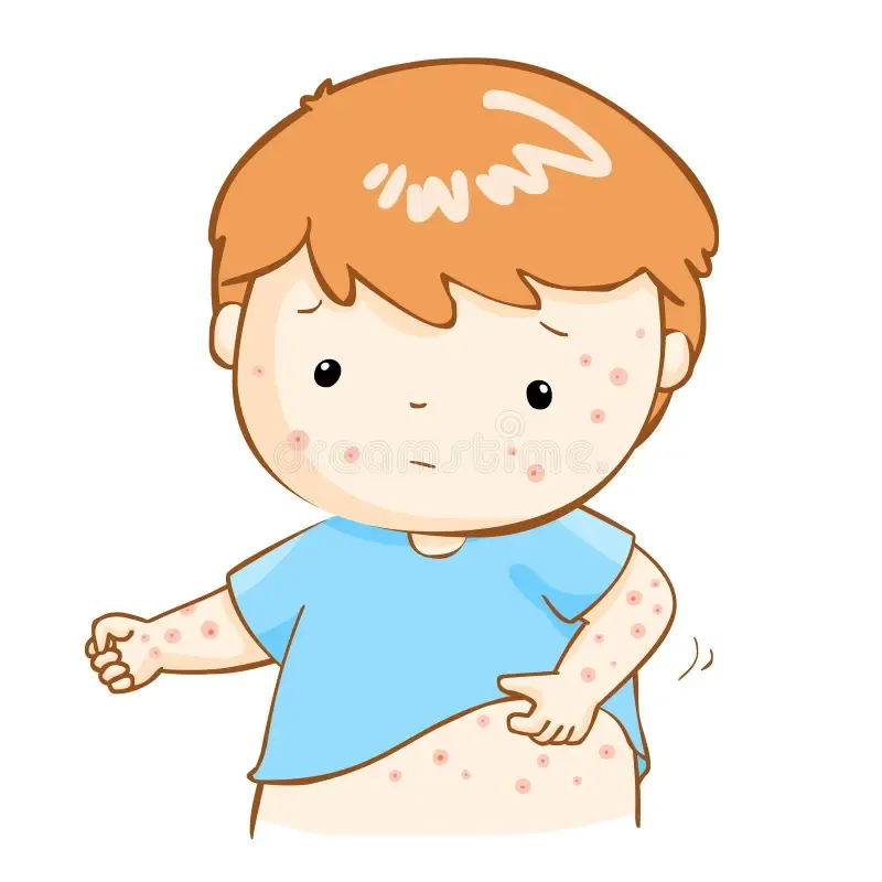 Rash