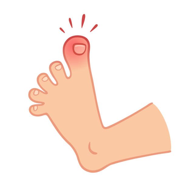 Swelling