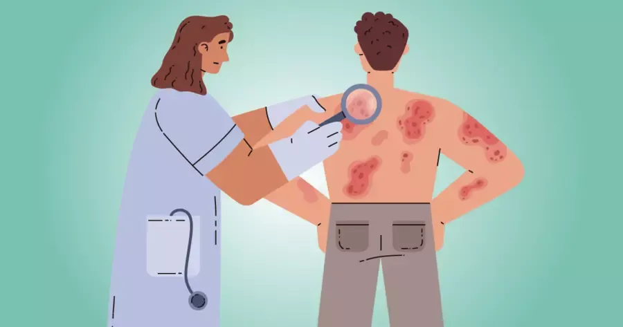 The rash will go away soon.