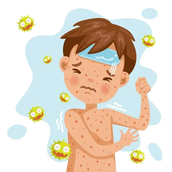 You have chickenpox.