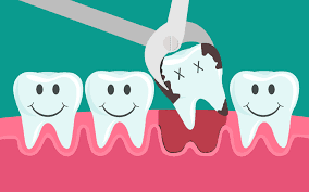 Nhấn để nghe You might need to get your tooth pulled.
